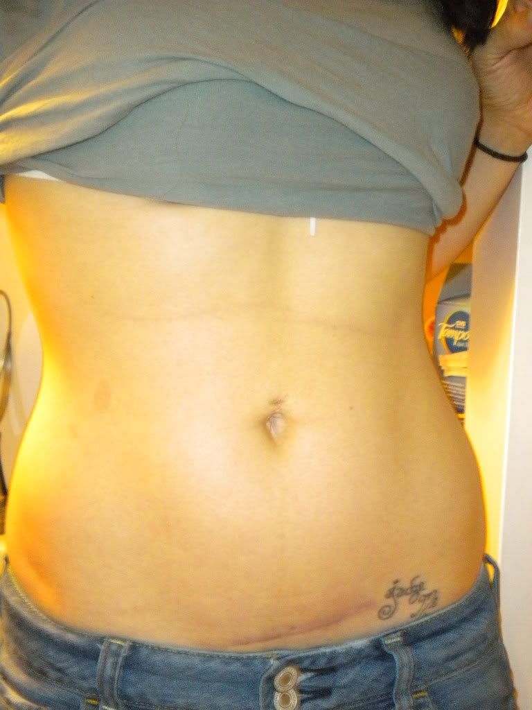 postpartum-belly-extra-petite