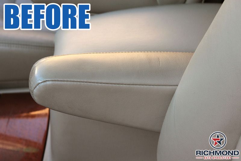  photo BeforeAfter-Arm-1_zpsmojn8frl.jpg