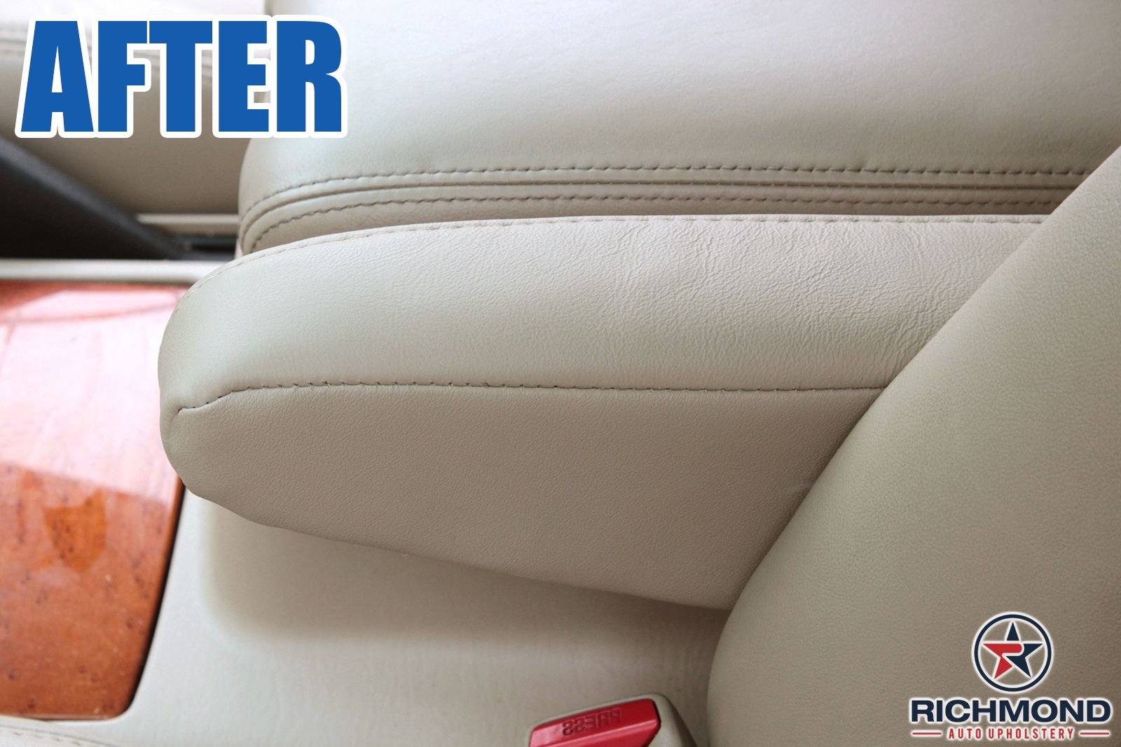  photo BeforeAfter-Arm-2_zpsyfasuvux.jpg